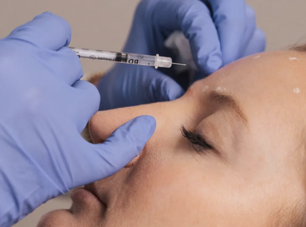 Why Choosing Laser Center of Marin, CA Ensures Advanced Aesthetic Solutions
